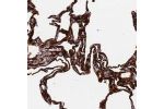 Immunohistochemical staining of human lung shows strong cytoplasmic positivity in pneumocytes.