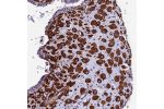 Immunohistochemical staining of human placenta shows strong cytoplasmic positivity in decidual cells.