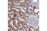 Immunohistochemical staining of human kidney shows strong granular cytoplasmic positivity in cells in tubules.