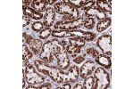 Immunohistochemical staining of human kidney shows strong granular cytoplasmic positivity in cells in tubules.