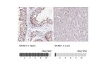 Immunohistochemistry analysis in human testis and liver tissues using Anti-BARD1 antibody. Corresponding BARD1 RNA-seq data are presented for the same tissues.