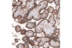 Immunohistochemical staining of human placenta shows strong membranous positivity in trophoblastic cells.