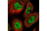 Immunofluorescent staining of human cell line A-431 shows localization to nucleoplasm.