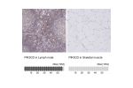 Immunohistochemistry analysis in human lymph node and skeletal muscle tissues using HPA044953 antibody. Corresponding PIK3CD RNA-seq data are presented for the same tissues.
