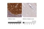 Immunohistochemistry analysis in human tonsil and skeletal muscle tissues using HPA044968 antibody. Corresponding HMCES RNA-seq data are presented for the same tissues.