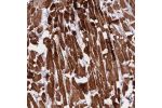 Immunohistochemical staining of human heart muscle shows strong cytoplasmic positivity in myocytes.