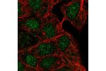Immunofluorescent staining of human cell line RT4 shows localization to nucleus.