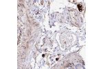 Immunohistochemical staining of human gastrointestinal shows strong cytoplasmic positivity in peripheral ganglion.