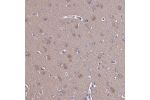 Immunohistochemical staining of human cerebral cortex shows weak cytoplasmic positivity in neurons.