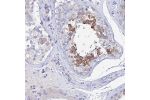 Immunohistochemical staining of human testis shows strong cytoplasmic positivity in a subset of seminiferus ducts.