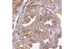Immunohistochemical staining of human prostate shows strong cytoplasmic and membranous positivity in glandular cells.