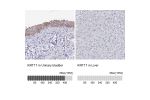 Immunohistochemistry analysis in human urinary bladder and liver tissues using HPA045062 antibody. Corresponding KRT17 RNA-seq data are presented for the same tissues.