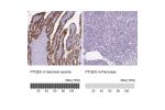 Immunohistochemical staining of human testis shows weak to moderate membranous and cytoplasmic positivity in cells in seminiferous ducts.