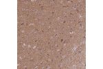 Immunohistochemical staining of human cerebral cortex shows strong cytoplasmic positivity in neuronal cells, subset of glial cells and in neuropil.