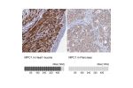 Immunohistochemistry analysis in human heart muscle and pancreas tissues using HPA045119 antibody. Corresponding MPC1 RNA-seq data are presented for the same tissues.