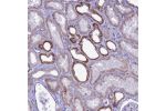 Immunohistochemical staining of human kidney shows strong cytoplasmic positivity in renal tubules.