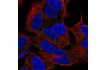 Immunofluorescent staining of human cell line SH-SY5Y shows localization to vesicles.