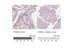 Immunohistochemistry analysis in human testis and skeletal muscle tissues using HPA045153 antibody. Corresponding PRAME RNA-seq data are presented for the same tissues.