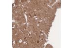 Immunohistochemical staining of human cerebral cortex shows moderate cytoplasmic positivity in neuronal cells and in neuropil.