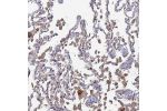 Immunohistochemical staining of human lung shows moderate cytoplasmic positivity in macrophages.