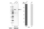 Western blot analysis in human cell lines Caco-2 and A-431 using Anti-BICC1 antibody. Corresponding BICC1 RNA-seq data are presented for the same cell lines. Loading control: Anti-PPIB.