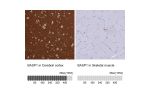 Immunohistochemistry analysis in human cerebral cortex and skeletal muscle tissues using HPA045218 antibody. Corresponding BASP1 RNA-seq data are presented for the same tissues.