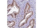 Immunohistochemical staining of human gallbladder shows nuclear positivity in glandular cells.