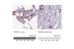 Immunohistochemistry analysis in human lung and placenta tissues using Anti-NAPSA antibody. Corresponding NAPSA RNA-seq data are presented for the same tissues.