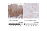 Immunohistochemistry analysis in human esophagus and skeletal muscle tissues using HPA045288 antibody. Corresponding WASF2 RNA-seq data are presented for the same tissues.