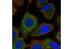 Immunofluorescent staining of human cell line A549 shows localization to cytosol.