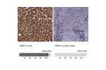 Immunohistochemistry analysis in human liver and lymph node tissues using HPA045339 antibody. Corresponding GHR RNA-seq data are presented for the same tissues.