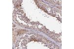 Immunohistochemical staining of human testis shows moderate cytoplasmic positivity in cells in seminiferus ducts.