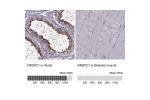 Immunohistochemistry analysis in human testis and skeletal muscle tissues using HPA045423 antibody. Corresponding PABPC1 RNA-seq data are presented for the same tissues.