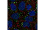 Immunofluorescent staining of human cell line RT4 shows localization to vesicles.