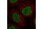 Immunofluorescent staining of human cell line A-431 shows localization to nucleoplasm & nuclear membrane.