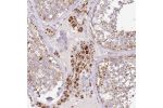 Immunohistochemical staining of human testis shows strong granular positivity in cytoplasm in Leydig cells.