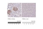 Immunohistochemistry analysis in human kidney and liver tissues using Anti-PODXL antibody. Corresponding PODXL RNA-seq data are presented for the same tissues.
