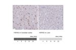 Immunohistochemistry analysis in human cerebral cortex and liver tissues using HPA045607 antibody. Corresponding NOVA2 RNA-seq data are presented for the same tissues.