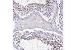 Immunohistochemical staining of human testis shows strong cytoplasmic positivity in subset of cells in seminiferus ducts.