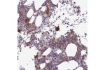 Immunohistochemical staining of human bone marrow shows strong cytoplasmic positivity in hematopoietic cells.