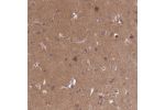 Immunohistochemical staining of human pancreas shows moderate cytoplasmic and nuclear positivity in exocrine glandular cells.