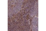 Immunohistochemical staining of human tonsil shows strong cytoplasmic positivity in non-germinal center cells.