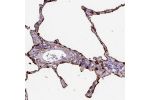 Immunohistochemical staining of human lung shows strong cytoplasmic and membranous positivity in pneumocytes.