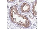 Immunohistochemical staining of human Testis shows strong nuclear and cytoplasmic positivity in cells in seminiferous ducts.