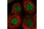 Immunofluorescent staining of human cell line A-431 shows localization to nucleoplasm & cell junctions.