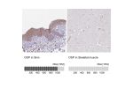 Immunohistochemistry analysis in human skin and skeletal muscle tissues using HPA045840 antibody. Corresponding DSP RNA-seq data are presented for the same tissues.
