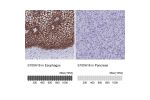 Immunohistochemistry analysis in human esophagus and pancreas tissues using HPA045841 antibody. Corresponding S100A16 RNA-seq data are presented for the same tissues.