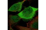 Immunofluorescent staining of human cell line U-251 MG shows localization to nucleoplasm & cytosol.