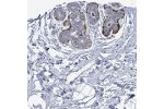 Immunohistochemical staining of human breast shows moderate cytoplasmic positivity in myoepithelial cells.