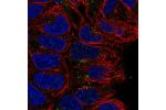 Immunofluorescent staining of human cell line RT4 shows localization to vesicles.